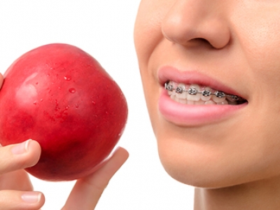 Γυναίκα τρώει κόκκινο μήλο