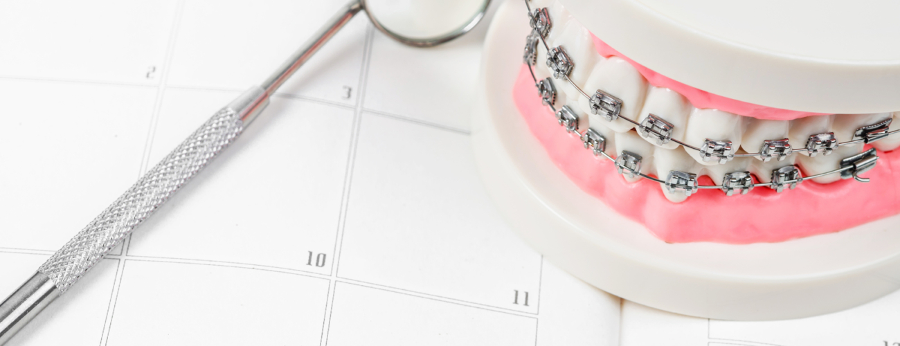 https://www.siderakiakontos.gr/wp-content/uploads/2023/03/27189190_tooth-model-with-metal-wire-dental-braces-on-a-calendar-1300x500.jpg